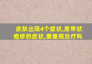 皮肤出现4个症状,是带状疱疹的症状,要重视治疗吗